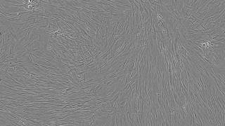 Osteogenic Differentiation of Human Mesenchymal Stem Cells [upl. by Harbison]