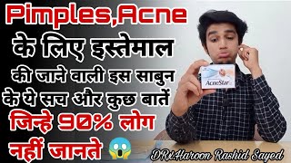 Acnestar Soap ko kaise use kare  Acnestar Soap side effects And Benefits  Honest Review [upl. by Yror284]