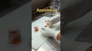 Appendix specimen grossing for tissue processing in histopathology [upl. by Iharas609]