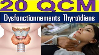 20 QCM Hyperthyroïdie ou Hypothyroïdie  Découvrez les Causes et Solutions [upl. by Annohsak]