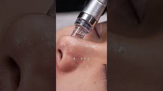 Lets hydrate her skin today immersiveskincare blackheads deepporecleansing skinmanagement asmr [upl. by Sutherland]