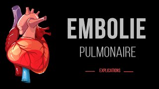 Embolie Pulmonaire  Cardiologie Urgence  Détails [upl. by Meggs682]