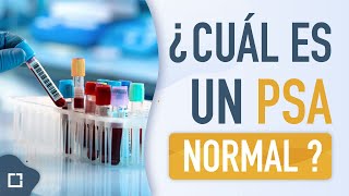 Próstata inflamada o grande ¿cual es un PSA NORMAL [upl. by Nnylakcaj]