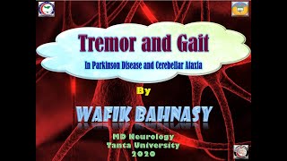 Parkinson and Cerebellar tremor and gait [upl. by Einahpts718]