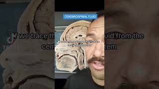 Cerebrospinal fluid brain [upl. by Morocco]