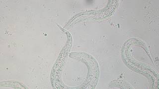 Strongyloides stercoralis larvae x400  Dog [upl. by Adnahsal161]