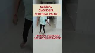 Physical diagnosis Spastic Quadriparesiscerebralpalsyneurologyphysiotherapylearningmrirehab [upl. by Gnap]