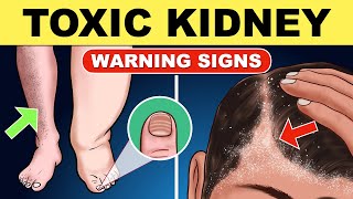 10 Warning Signs That Your Kidneys are Toxic  Chronic Kidney Disease  Kidney Health  CKD [upl. by Urion]