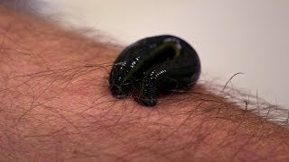 Michael Mosley is bitten by a leech  Infested Living with Parasites  BBC Four [upl. by Marlena]