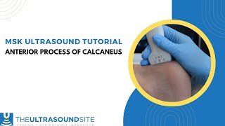 MSK ultrasound evaluation on how to find the anterior process of the calcaneus [upl. by Elem]