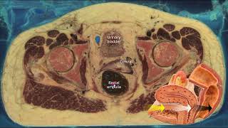 Cross sectional anatomy of the female pelvis [upl. by Nessim]