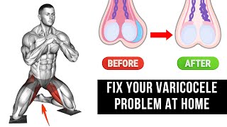 Top 6 Effective Exercises for Varicocele Treatment at Home [upl. by Eiboj]