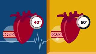 Ejection Fraction  Heart Health  Rose Heart amp Vascular Center [upl. by Nohtahoj451]