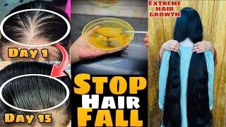 How to Stop Hair Fall NaturallyGrow Hair FasterRegrow Hair SolutionRemedy  Zonnilifestyle [upl. by Lrae]