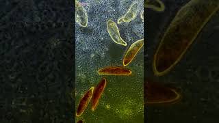 Iodine vs Germs Under Microscope 2 iodine [upl. by Okemak783]