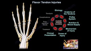 Flexor Tendon Injuries  Everything You Need To Know  Dr Nabil Ebraheim [upl. by Eylsel198]