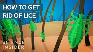 Why Lice Are So Hard To Kill [upl. by Vinni]