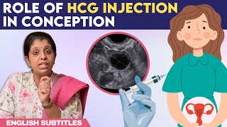 Role Of hCG Injection In Conception  hCG ஊசி செலுத்திய பிறகு கரு முட்டை எப்போது வெளிவரும் [upl. by Sandeep640]