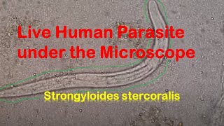 Human Parasites Live under the Microscope  Strongyloides stercoralis [upl. by Frederich]