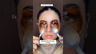 Remove Dark Circles Naturally At Home In 1DayUnderEye Dark Circles Remove Homeremedy dark shorts [upl. by Kean237]