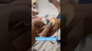 Cannula insertion of female patient nurses cannula doctor youtubeshorts shorts ytshorts neet [upl. by Sheeree]