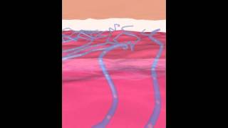 SPIDER VEINS animation how spider veins are formed [upl. by Anelleh]