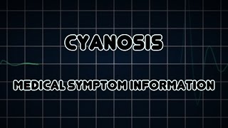 Cyanosis Medical Symptom [upl. by Suzan292]