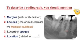 Periapical lesions practical session [upl. by Dulcinea]