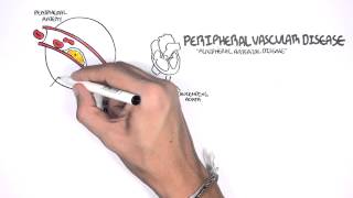 Cardiovascular Disease Overview [upl. by Hama683]