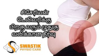 Back pain after Csection delivery in Tamil l சிசேரியன் டெலிவக்கு பிறகு வரும் முதுகு வலி தீர்வு [upl. by Dash]