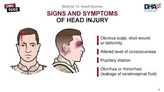 Signs of Lateralization in Head Injuries [upl. by Nairod579]