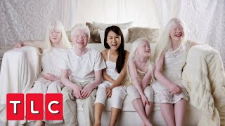 This Couple Adopted Four Children With Albinism  Born with Albinism [upl. by Royal973]