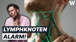 Unbekannte Knubbel Gefährlich von harmlos unterscheiden Wichtigsten Fakten zu großen Lymphknoten [upl. by Koffler299]