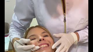 Botox para sorriso gengival [upl. by Zacharie]