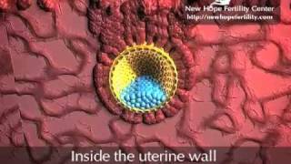 Embyro Implantation [upl. by Donelson]