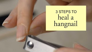 3 Steps to Heal a Hangnail [upl. by Eux136]