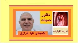 الزوائد القولونية والأورام الحميدة [upl. by Estey378]