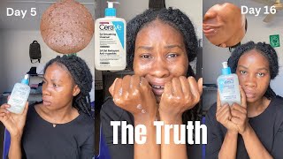 I TRIED CeraVe SA Smoothing Cleanser for 30 Days and This Happened Honest Review [upl. by Eidnew]