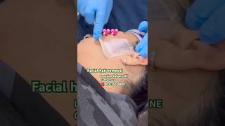 Facial hair removal💖💖shortfeed beauty facewax facial hairremoval hardwax beforeandafter fy [upl. by Novikoff]