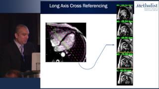 Advantages of CMR Imaging [upl. by Wolenik127]