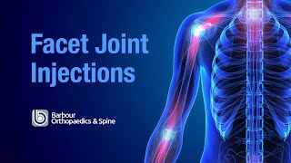 What are Facet Joint injections [upl. by Nanice]