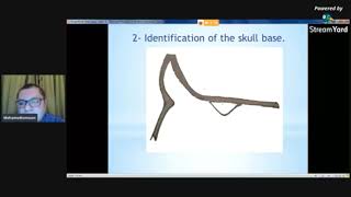 Frontal sinus surgery explained DrMohamed Tomoum [upl. by Ahse]