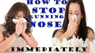 How To Stop Running Nose Immediately  Most Effective Natural Home Remedies For Runny Nose [upl. by Valora]