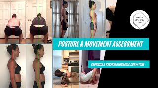 Kyphosis amp Reversed Thoracic Curvature  Posture Assessment  Waugh Personal Training [upl. by Anitselec565]