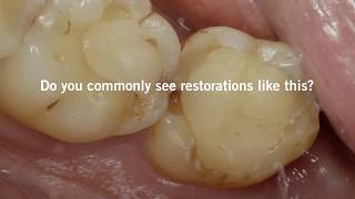 Tips amp tricks on light curing to ensure longlasting restorations EN [upl. by Orecic]