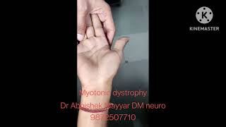 Myotonic dystrophy [upl. by Tshombe279]