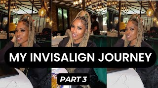 INVISALIGN JOURNEY PART 4  FINISHED SHAVING TEETH DOWN [upl. by Adekahs]