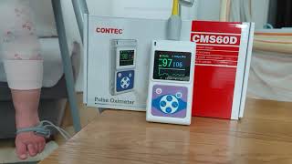 Pulsoksymetr Contec CMS 60d [upl. by Eira]