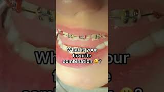 Changing braces colors  How often can I change braces colors  Tooth Time Dentist New Braunfels [upl. by Hudson]