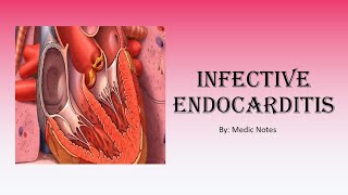 Cardiology Infective endocarditis  Dukes criteria Osler nodes Janeway lesions Roth spots [upl. by Pier]